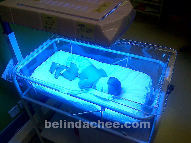 Dani had a little bit of jaundice so she had to go through phototherapy. 