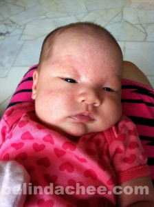 She had developed a rash on her entire face after turning 1 month old... =`(