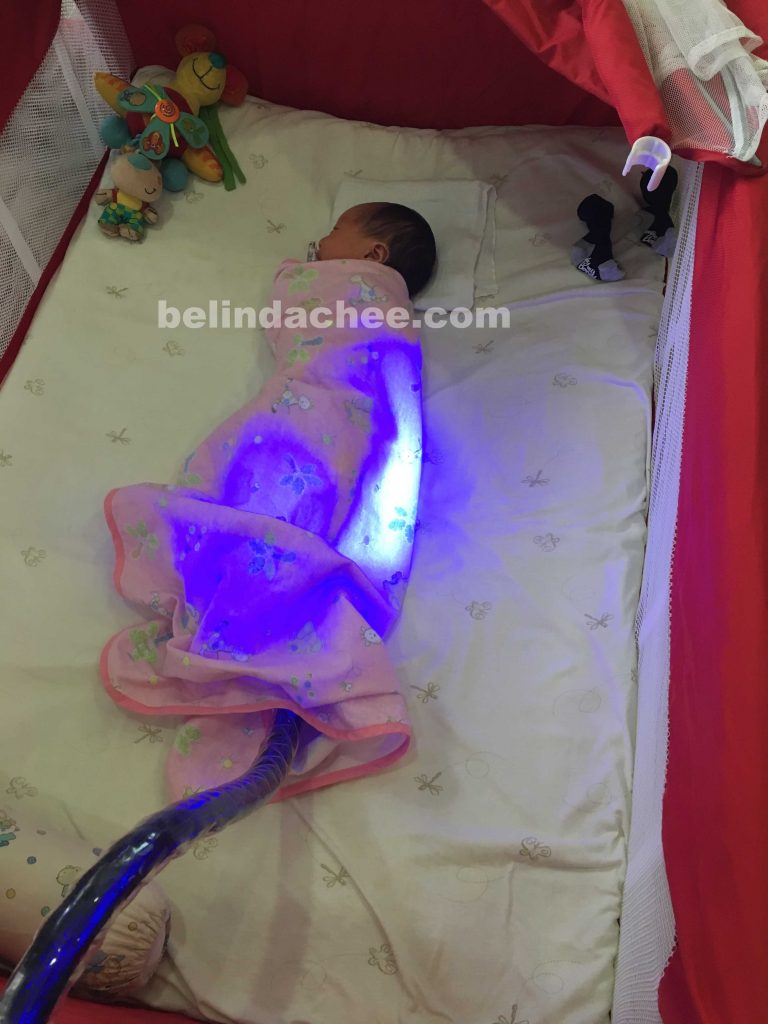 Dylan had jaundice and had to do phototherapy. Here he's using the Bili-Blanket, a new technology incorporated into phototheraphy. 
